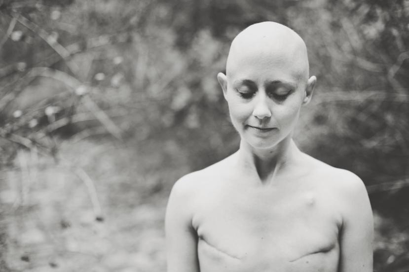 Diagnosed with Breast Cancer at 32, Then She Lost her Job