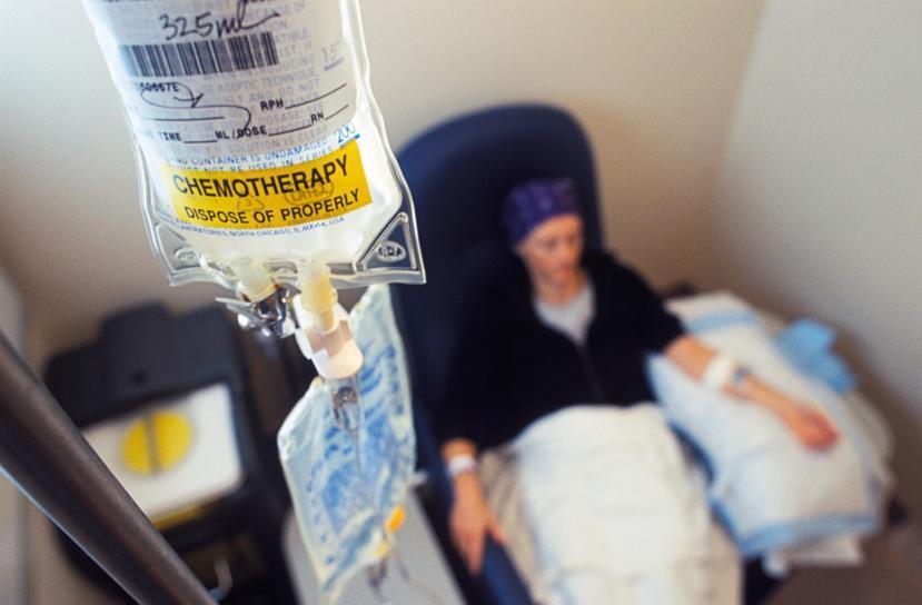 How to Prevent Breast Cancer from Spreading