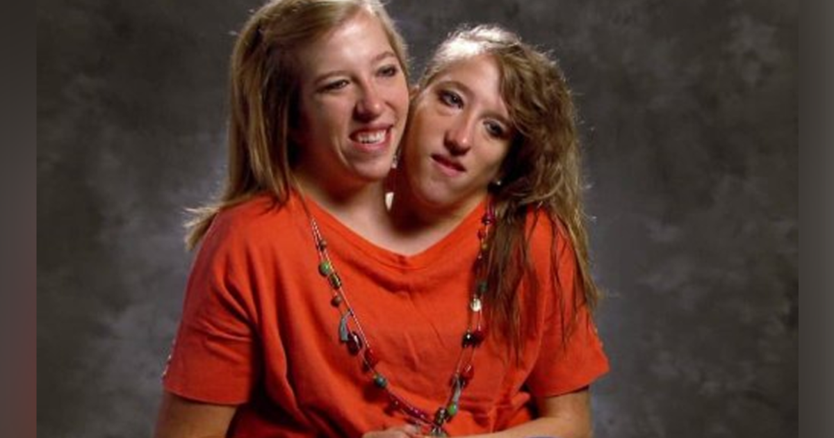 Siamese Twins Abby And Brittany Dating – Telegraph