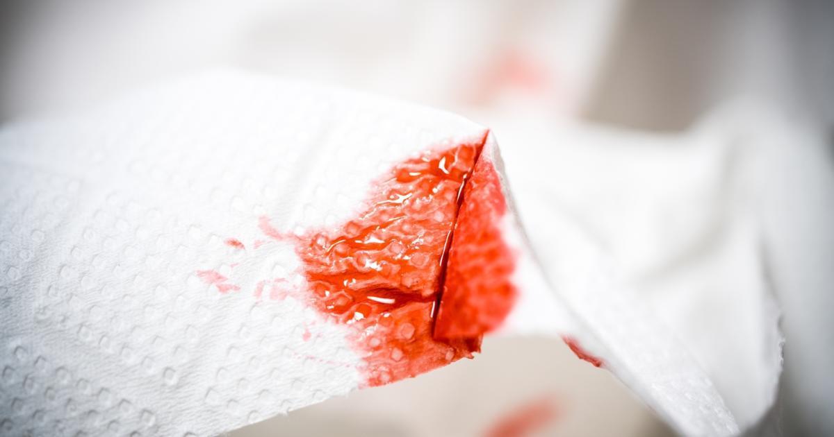 Implantation Bleeding or Period?