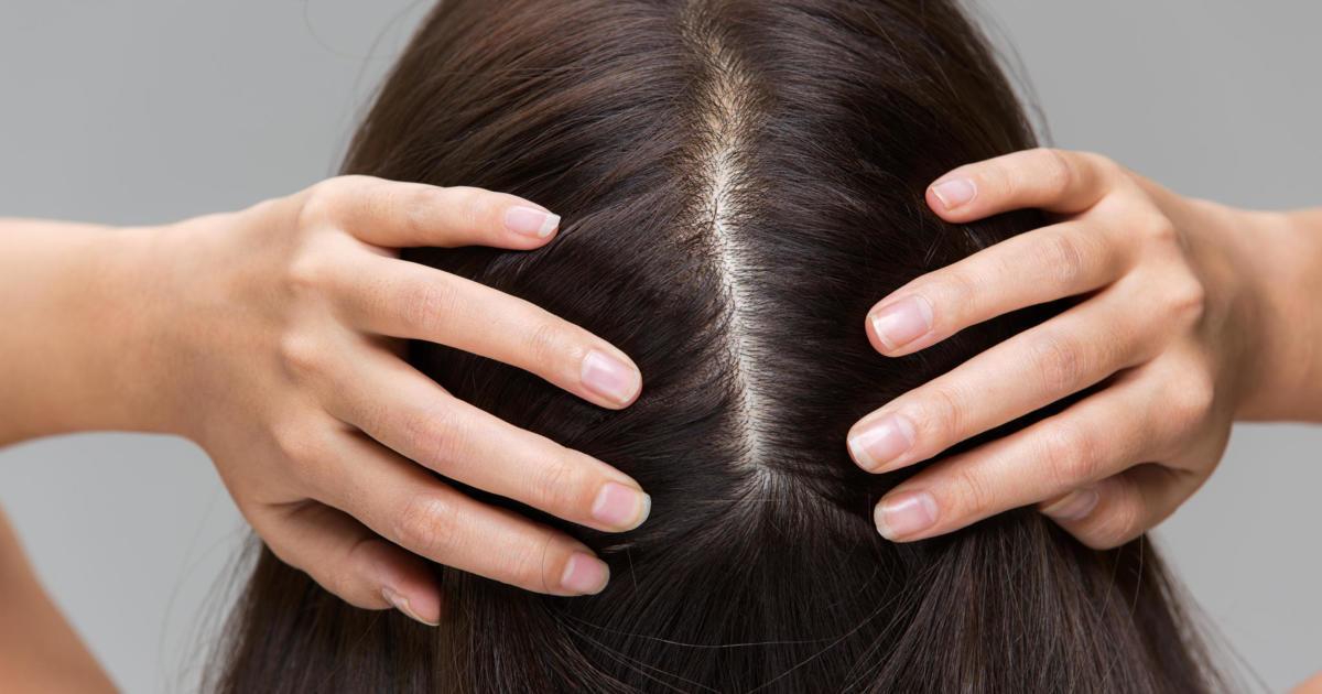 What Could Scabs on Your Scalp Be Telling You?