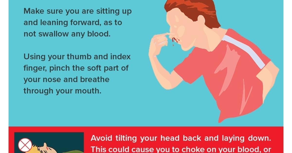 covid symptoms in kids bloody nose
