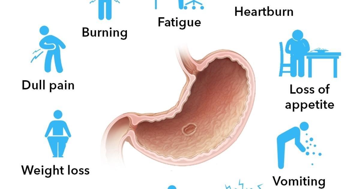 Stomach Ulcers Symptoms And Treatment