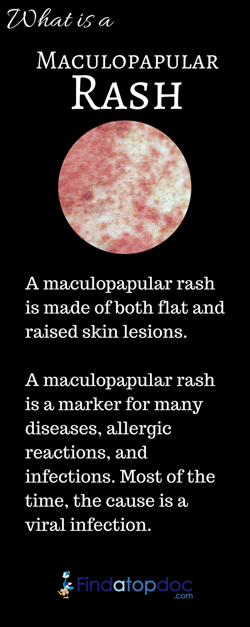 What is a Maculopapular Rash?