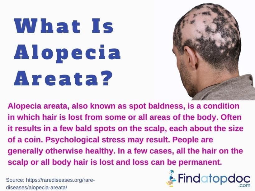 What Is Alopecia Areata Infographic