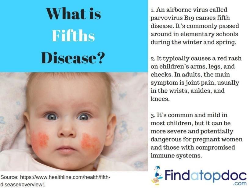 Fifths Disease Rash On Body - vrogue.co
