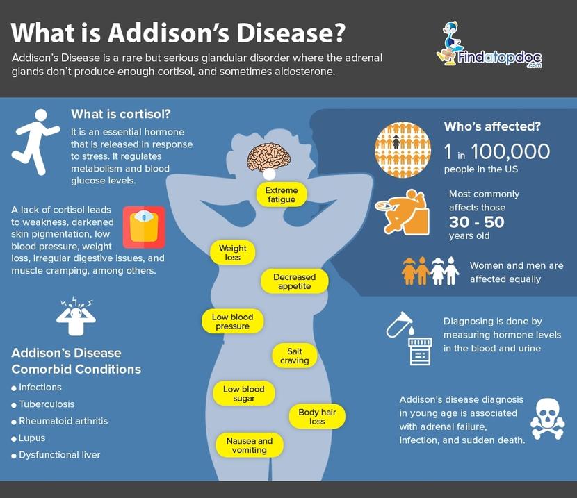 Addison's Disease Symptoms, Causes, Treatment, and Diagnosis FindATopDoc