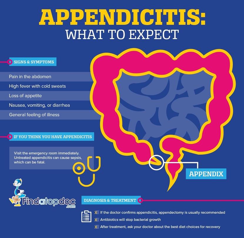รายการ 92 ภาพ Appendix ทางการแพทย์ ความละเอียด 2k 4k