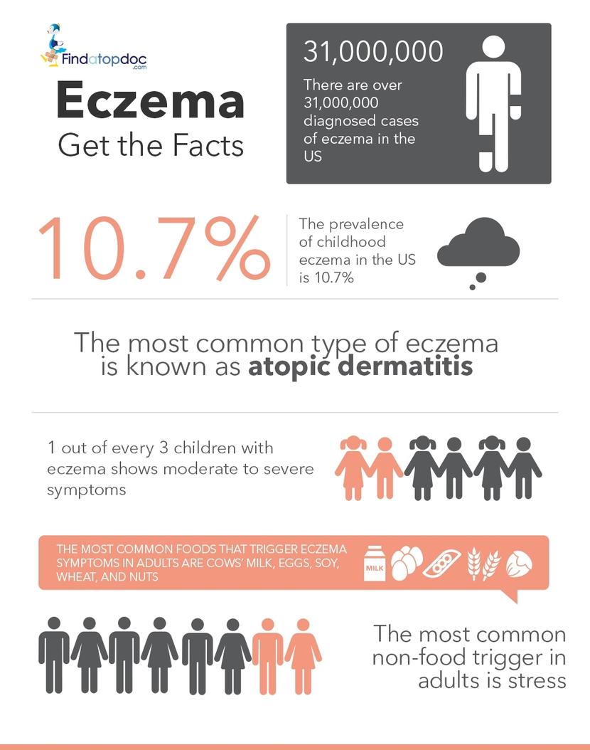 Interesting Facts About Atopic Dermatitis Eczema Infographic ...