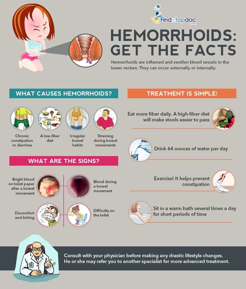 Hemorrhoids The Top 10 Questions