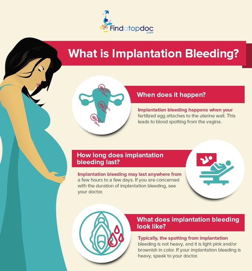 Implantation Bleeding Can Be Treated Findatopdoc