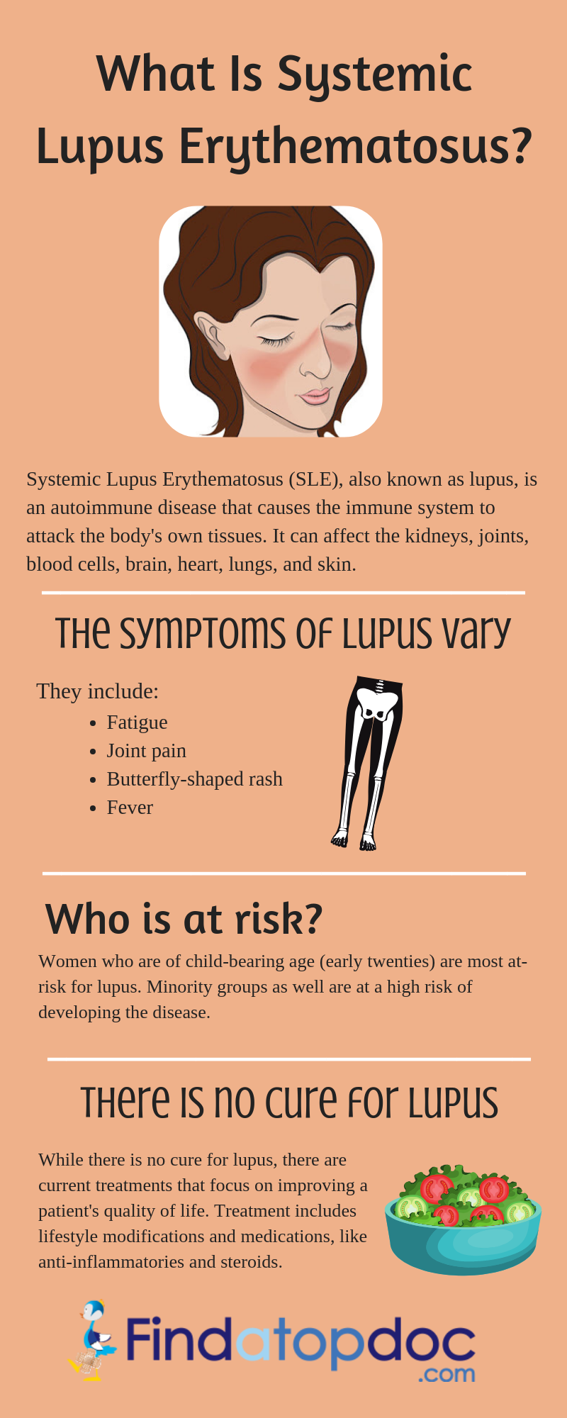 what happens with a lupus flare up