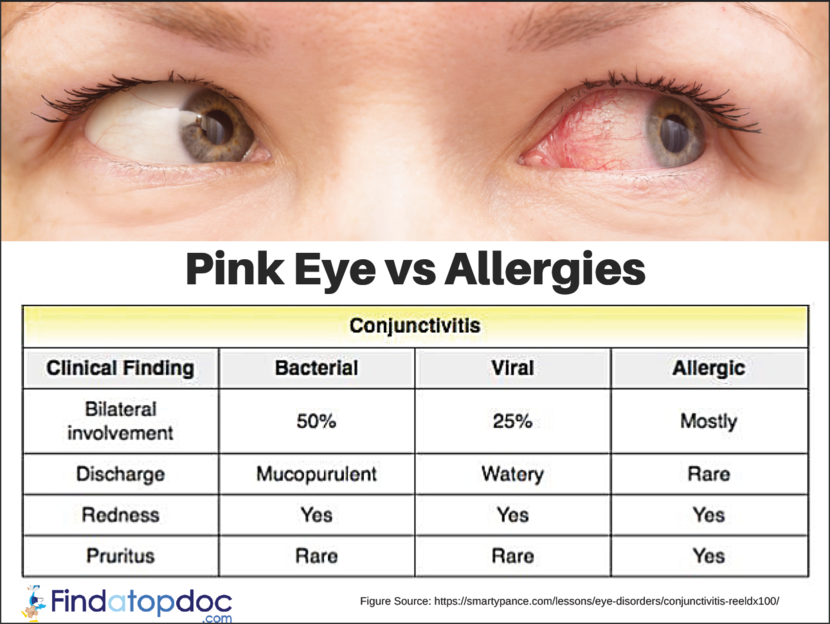Pink Eye Conjunctivitis Symptoms Causes Treatment And Diagnosis